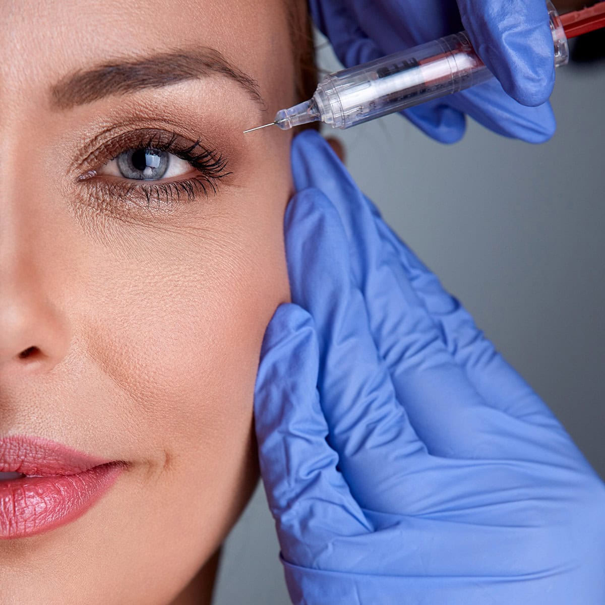 Botox treatment